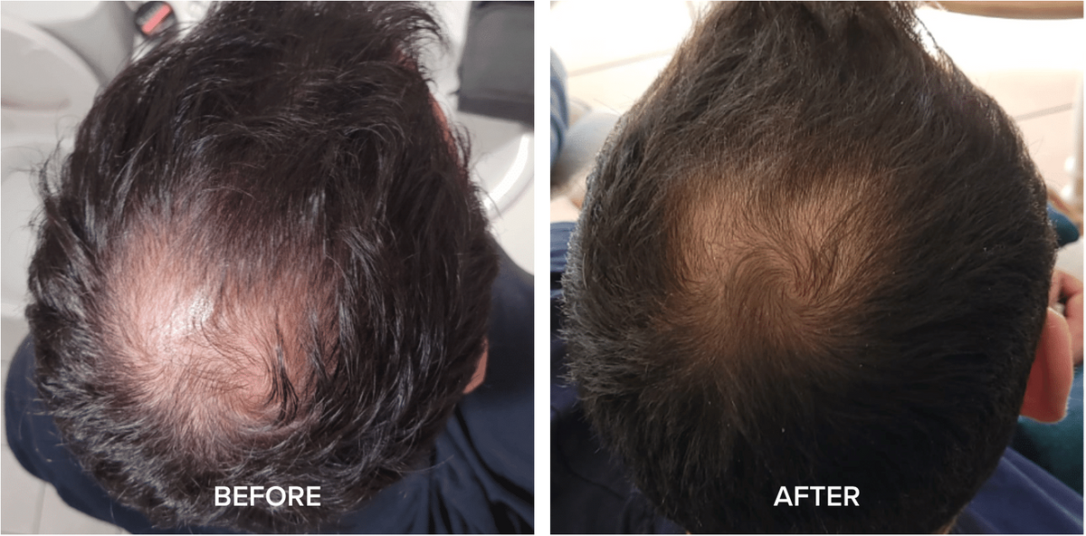 Cebelia Anti-Hair Loss Lotion